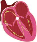 supraventricular tachycardias